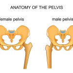 כאבי ירך – ההבדל בין גברים לנשים